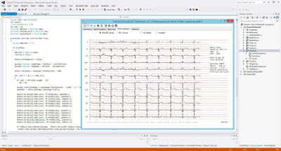 Sample Cardiac Rhythm on Chart. Using TeeChart for .NET in Visual Studio .NET. 
